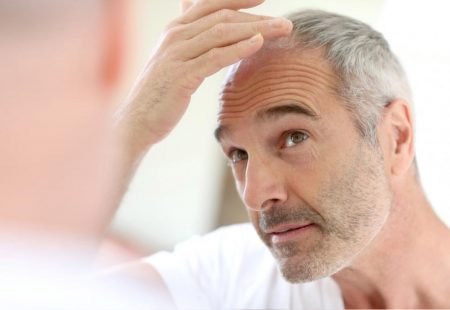 أمراض قد تمنعك من إجراء عملية زراعة الشعر