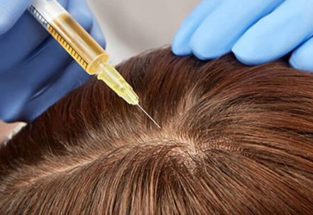 خطة أدوية متكاملة - حقن البلازما الضمان لنجاح زراعة الشعر